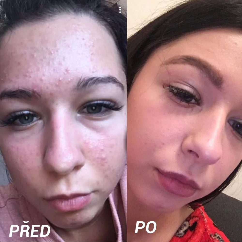 FaceDeluxe