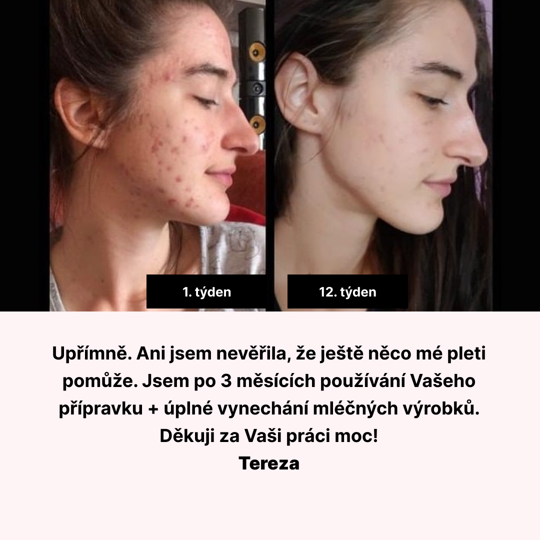 FaceDeluxe set – šestiměsíční kúra
